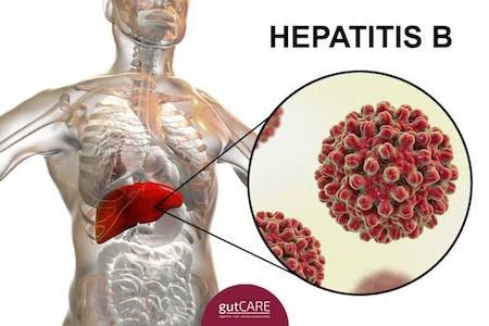 6 Things You Do That Can Lead To Hepatitis B