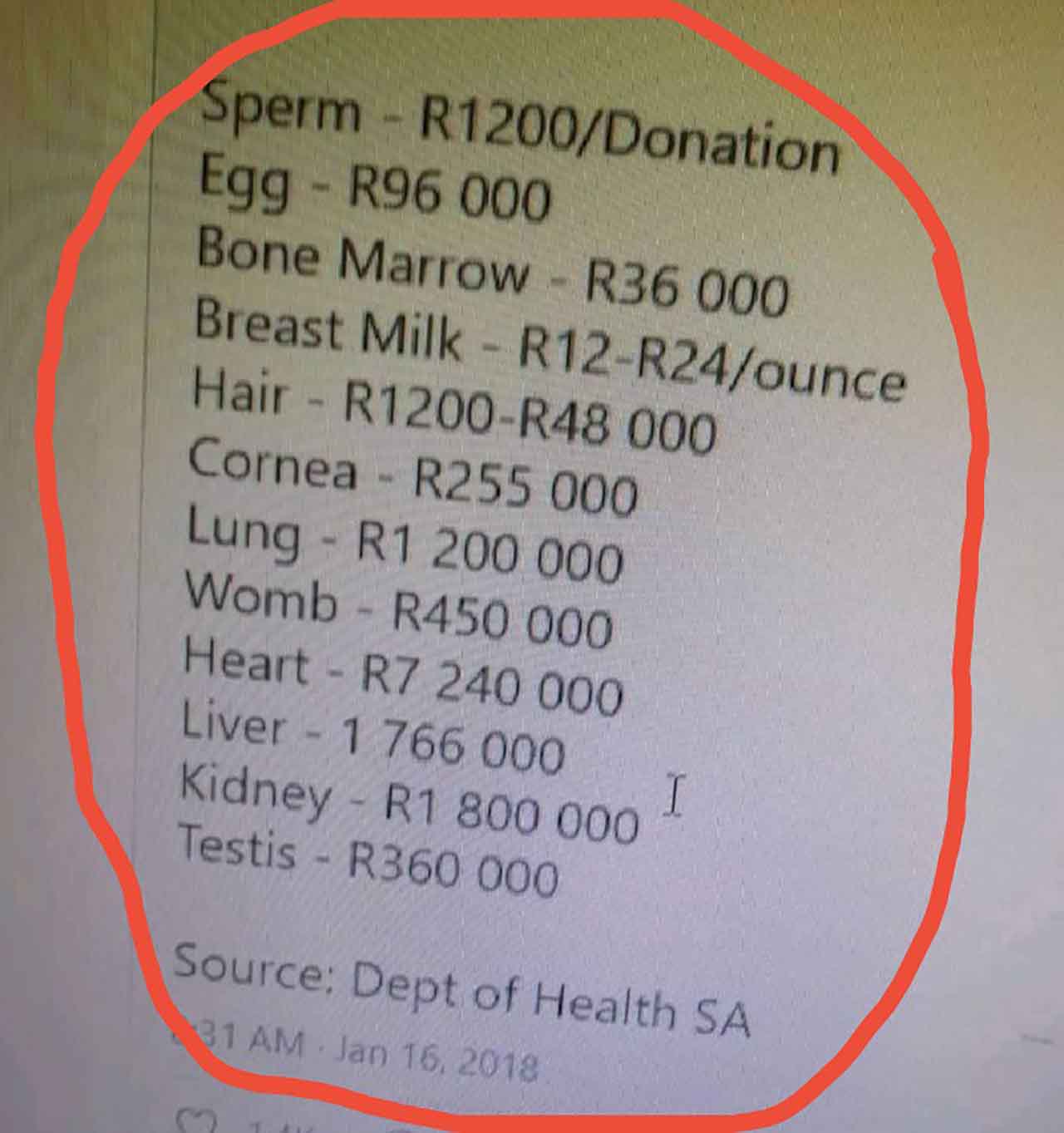 Shocking pics! the price tag of human organs from buyer to seller