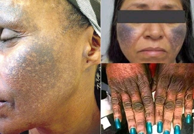 If You Are Using One Of These Lotions, Stop Immediately. Here Is What You Need To Know: Be Warned