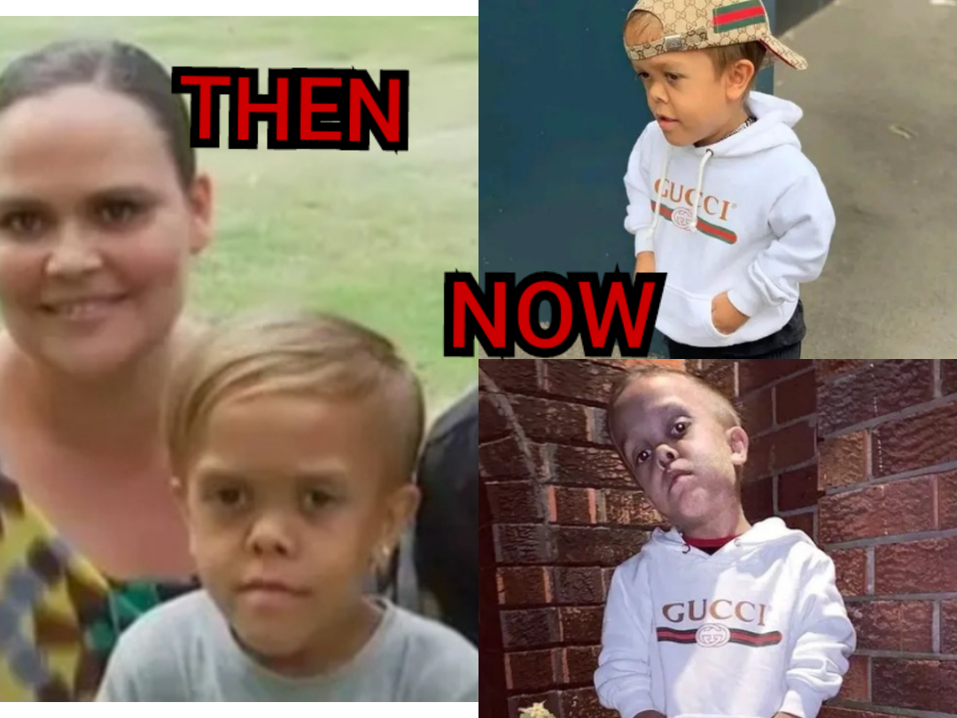 Remember The 11-year Old Boy That Once Tried To Kill Himself Due To His Height> See His New Looks