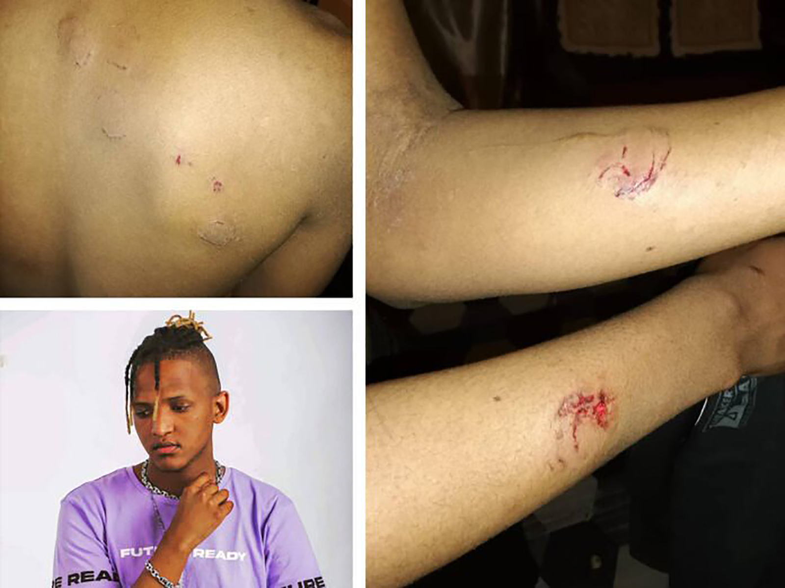 Shocking This was done by the teens fighting for their lives before death at Enyobeni