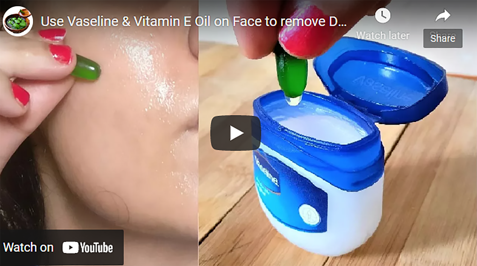 Watch: How To Use Vaseline & Vitamin E Oil On Your Face To Remove Dark Spots