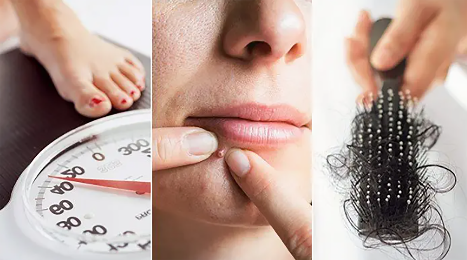 Warning signs you might have Polycystic Ovarian Syndrome Watch out