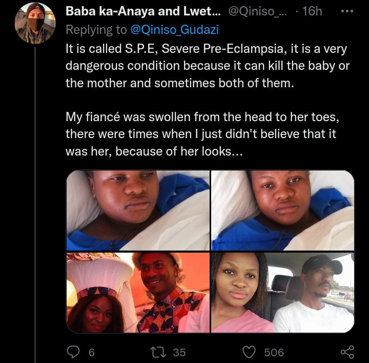 Prayers to the cute newborn after the serious sickness she is affected with from her mother