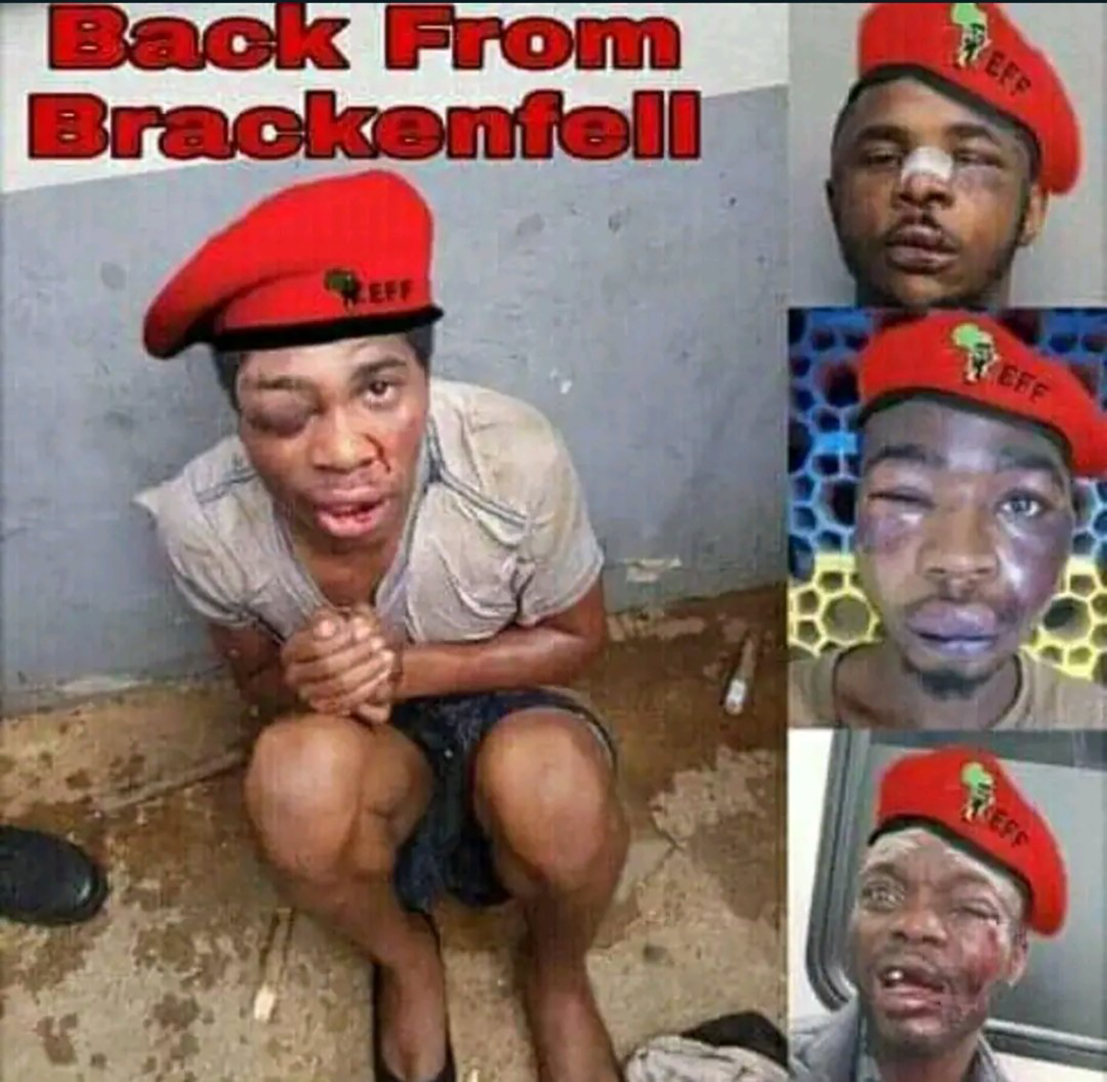 The Picture of Beaten EFF Members Go Viral SEE What Members Says