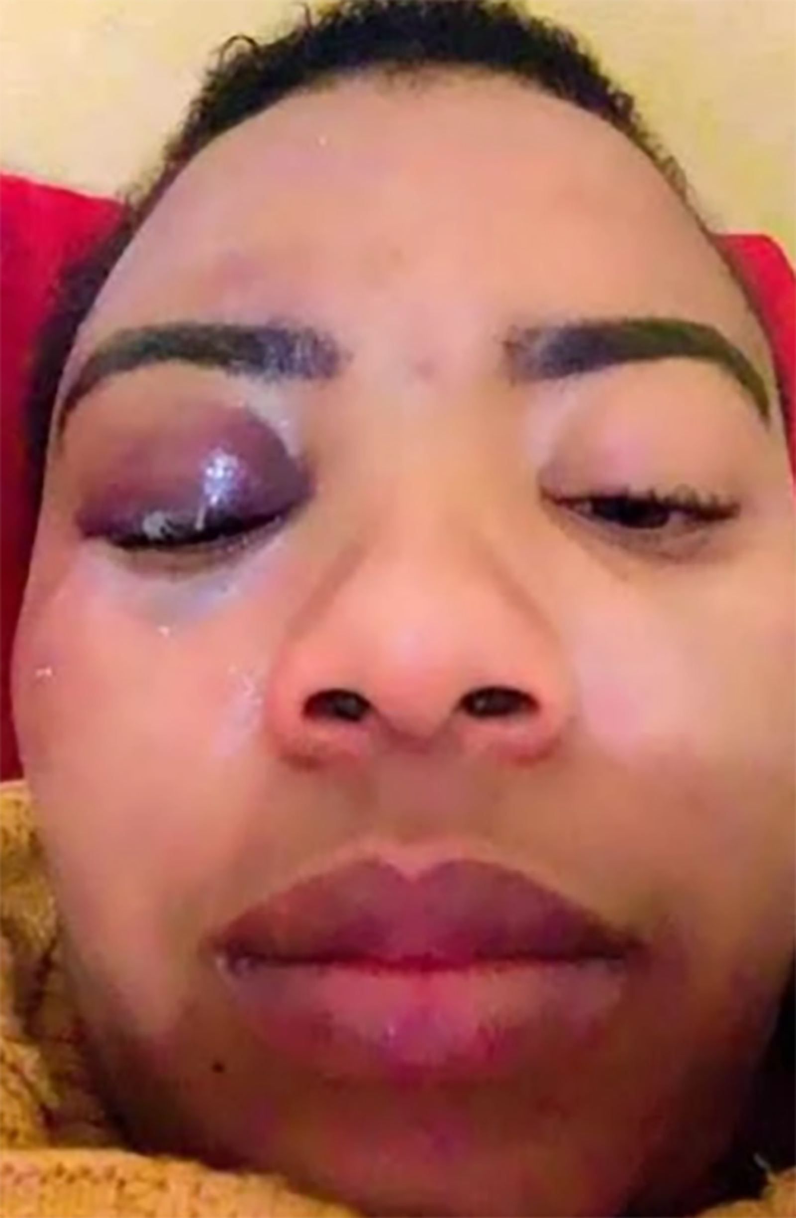 A nurse from Khayelitsha is being assaulted like Namhla Mtwa; by an ex boyfriend who is stalking her