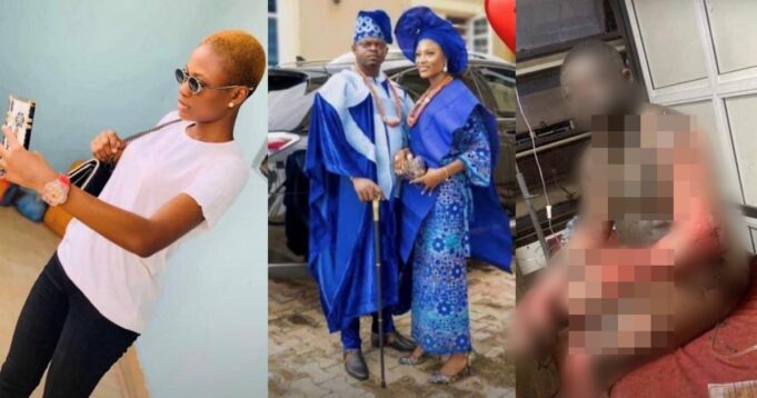 Police launch manhunt for wife who set her husband ablaze for allegedly having a child outside wedlock following reports she’s still alive