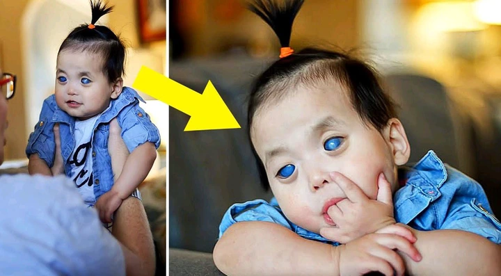 No One Wanted THIS Abandoned Child With Silver Eyes. Then They Notice a Picture