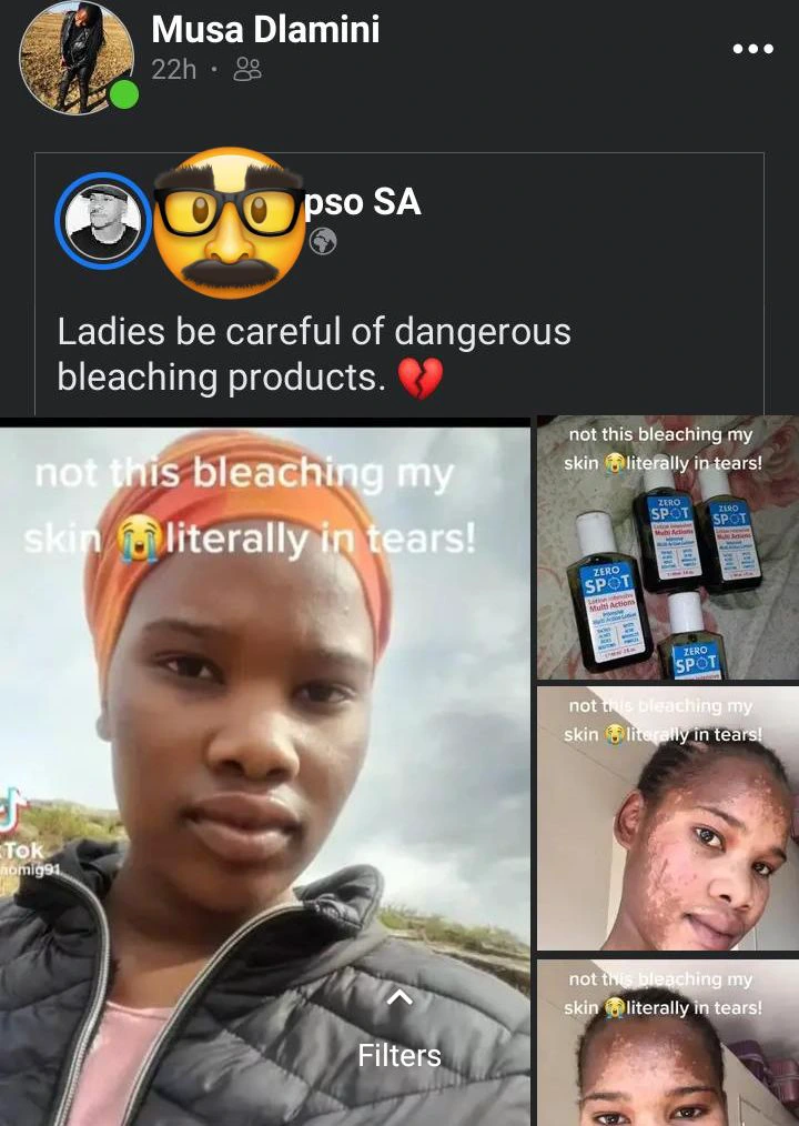 Ladies beware of products you apply on your face: this happened to her after using face bleach
